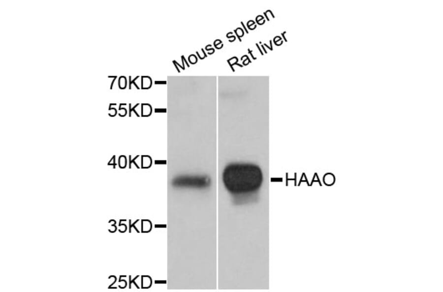 Western Blot - Anti-HAAO Antibody (A4559) - Antibodies.com