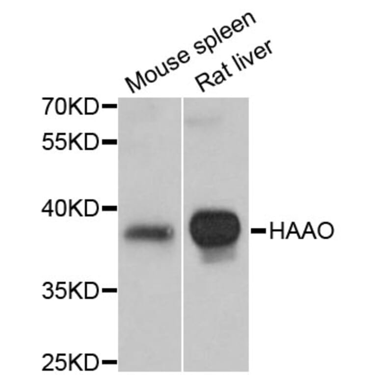 Western Blot - Anti-HAAO Antibody (A4559) - Antibodies.com