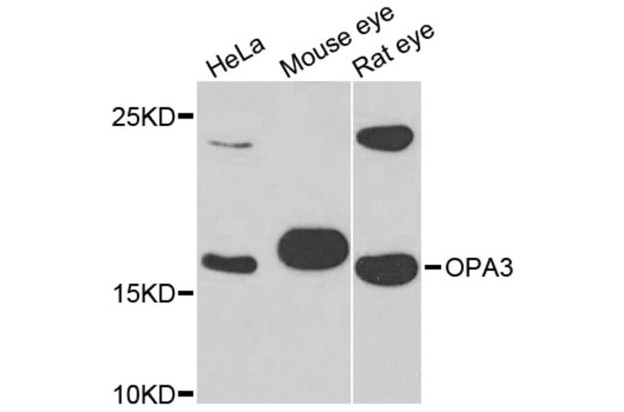 Western Blot - Anti-OPA3 Antibody (A4995) - Antibodies.com