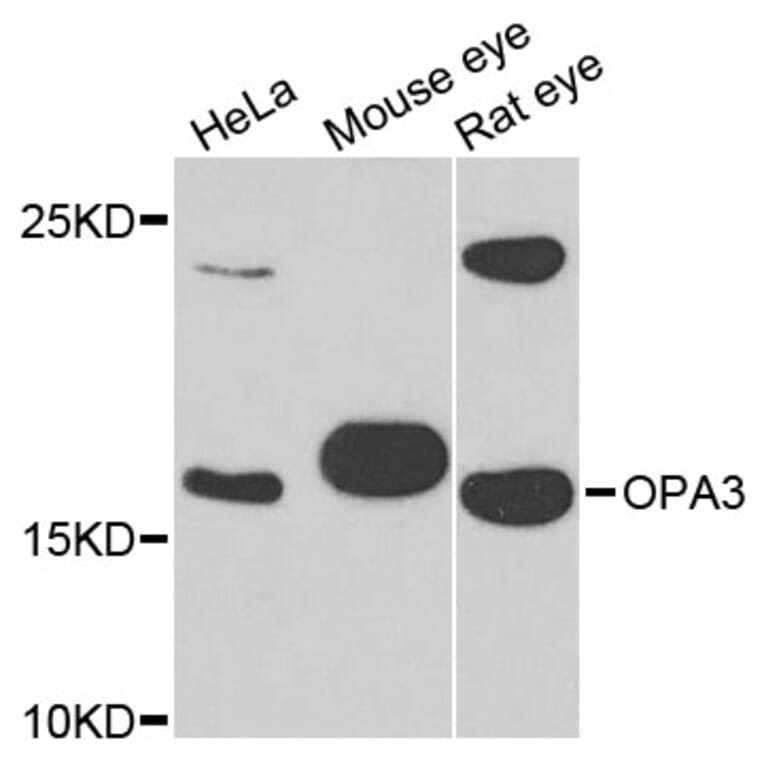 Western Blot - Anti-OPA3 Antibody (A4995) - Antibodies.com