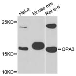 Western Blot - Anti-OPA3 Antibody (A4995) - Antibodies.com