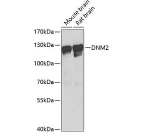Western Blot - Anti-Dynamin 2 Antibody (A81159) - Antibodies.com