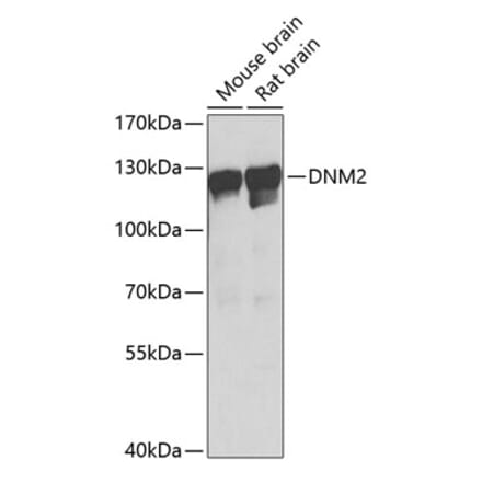 Western Blot - Anti-Dynamin 2 Antibody (A81159) - Antibodies.com