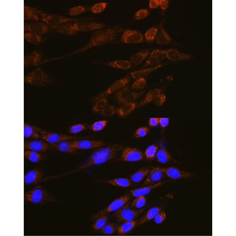 Immunofluorescence - Anti-Dynamin 2 Antibody (A81159) - Antibodies.com