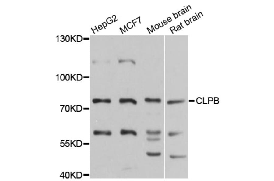 Western Blot - Anti-CLPB Antibody (A9130) - Antibodies.com
