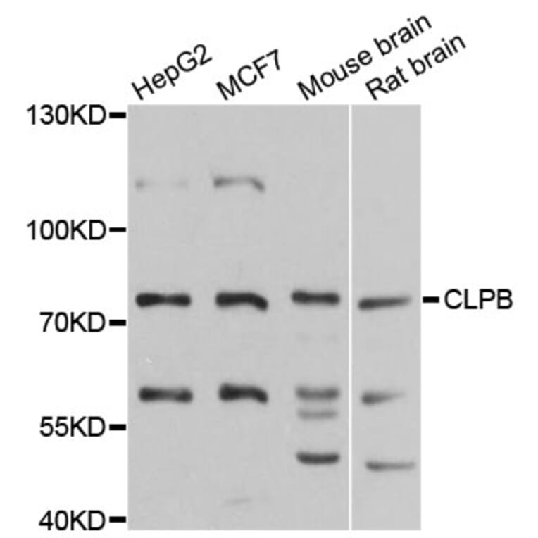 Western Blot - Anti-CLPB Antibody (A9130) - Antibodies.com