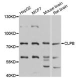 Western Blot - Anti-CLPB Antibody (A9130) - Antibodies.com