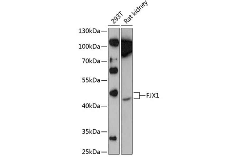 Western Blot - Anti-FJX1 Antibody (A81161) - Antibodies.com