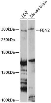 Western blot analysis of extracts of various cell lines, using Anti-FBN2 Antibody (A9414) at 1:3000 dilution.
Secondary antibody: Goat Anti-Rabbit IgG (H+L) (HRP) (AS014) at 1:10,000 dilution.
Lysates / proteins: 25µg per lane.
Blocking buffer: 3% non-fat dry milk in TBST.
Detection: ECL Basic Kit (RM00020).
Exposure time: 30s.