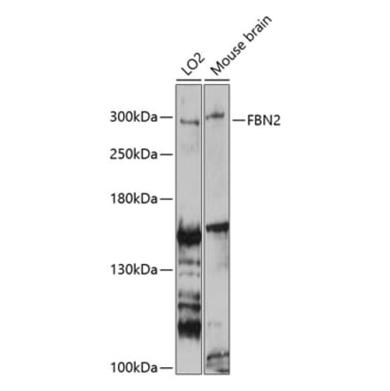 Western Blot - Anti-Fibrillin 2 Antibody (A81162) - Antibodies.com