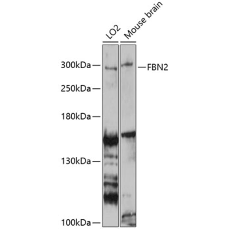 Western Blot - Anti-Fibrillin 2 Antibody (A81162) - Antibodies.com