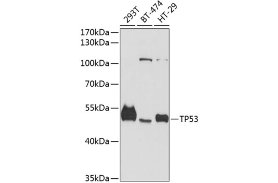 Western Blot - Anti-TP53 Antibody (A11799) - Antibodies.com