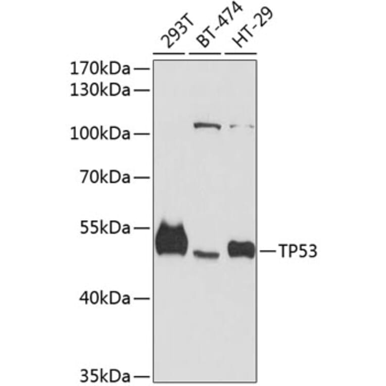 Western Blot - Anti-TP53 Antibody (A11799) - Antibodies.com