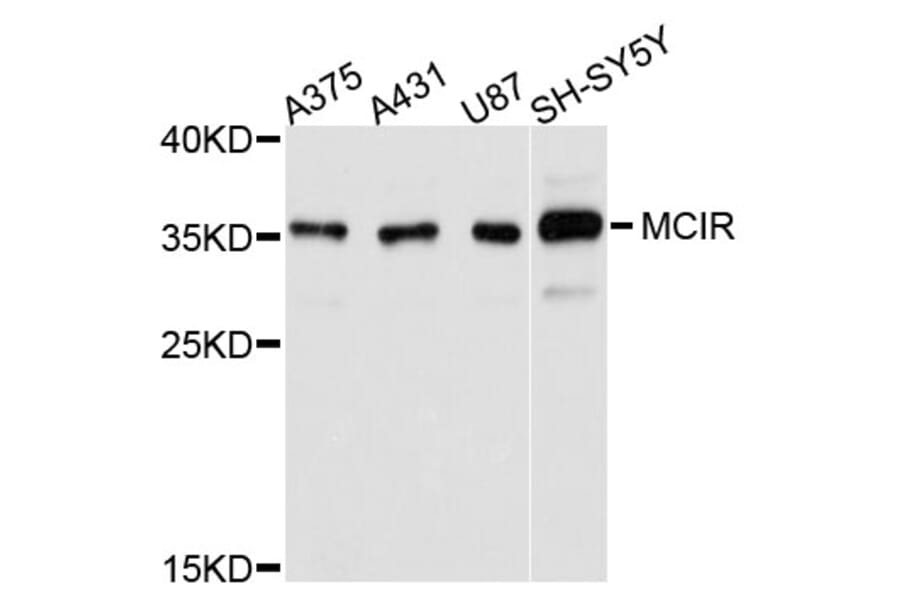 Western Blot - Anti-MC1R Antibody (A11803) - Antibodies.com