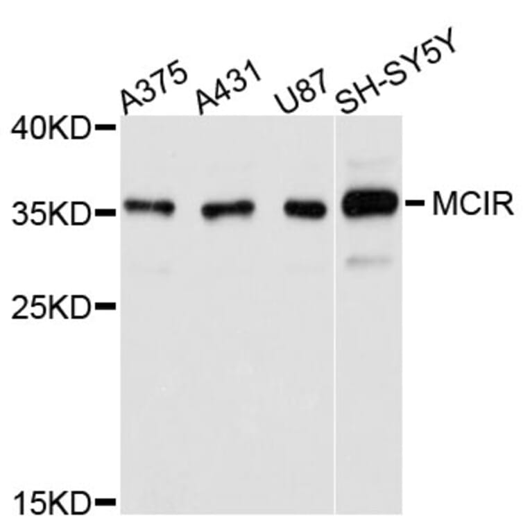 Western Blot - Anti-MC1R Antibody (A11803) - Antibodies.com