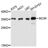 Western Blot - Anti-MC1R Antibody (A11803) - Antibodies.com