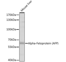 Western Blot - Anti-alpha 1 Fetoprotein Antibody (A81166) - Antibodies.com
