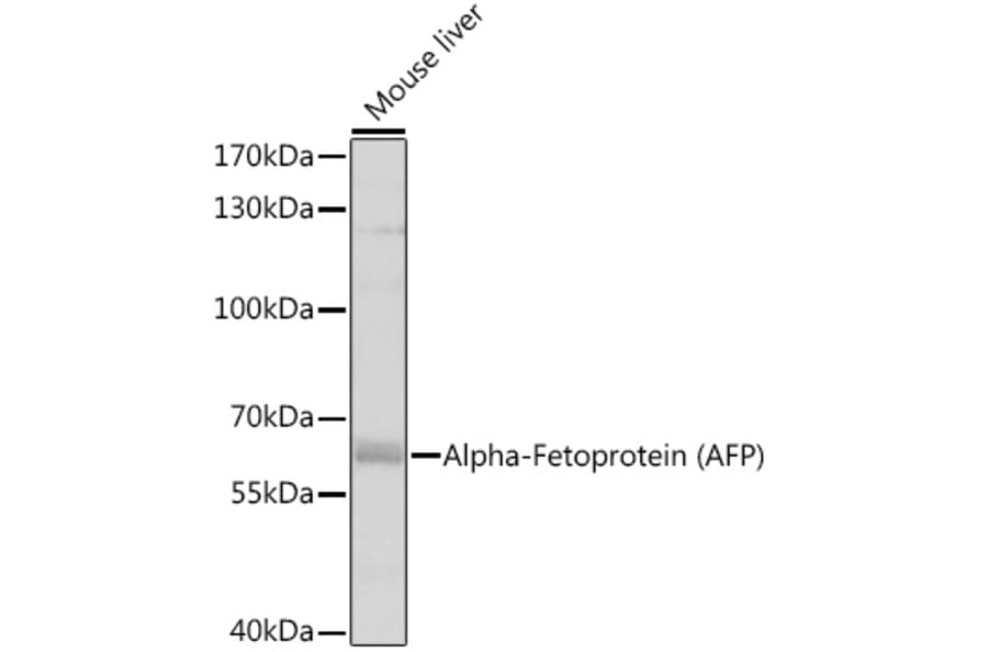 Western Blot - Anti-alpha 1 Fetoprotein Antibody (A81166) - Antibodies.com