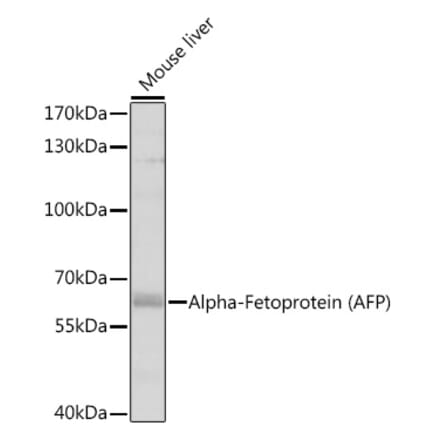 Western Blot - Anti-alpha 1 Fetoprotein Antibody (A81166) - Antibodies.com