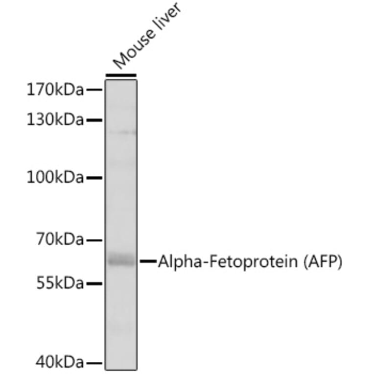 Western Blot - Anti-alpha 1 Fetoprotein Antibody (A81166) - Antibodies.com
