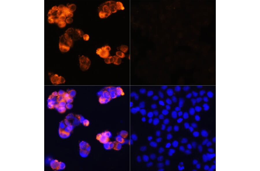 Immunofluorescence - Anti-alpha 1 Fetoprotein Antibody (A81166) - Antibodies.com