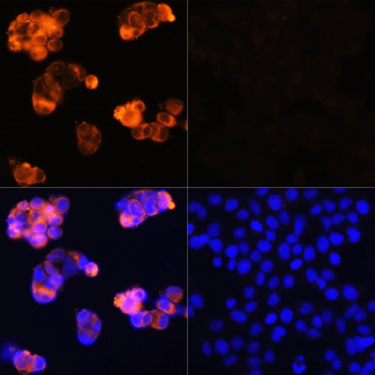 Immunofluorescence - Anti-alpha 1 Fetoprotein Antibody (A81166) - Antibodies.com