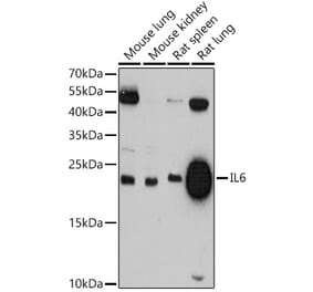 Western Blot - Anti-IL-6 Antibody (A81167) - Antibodies.com