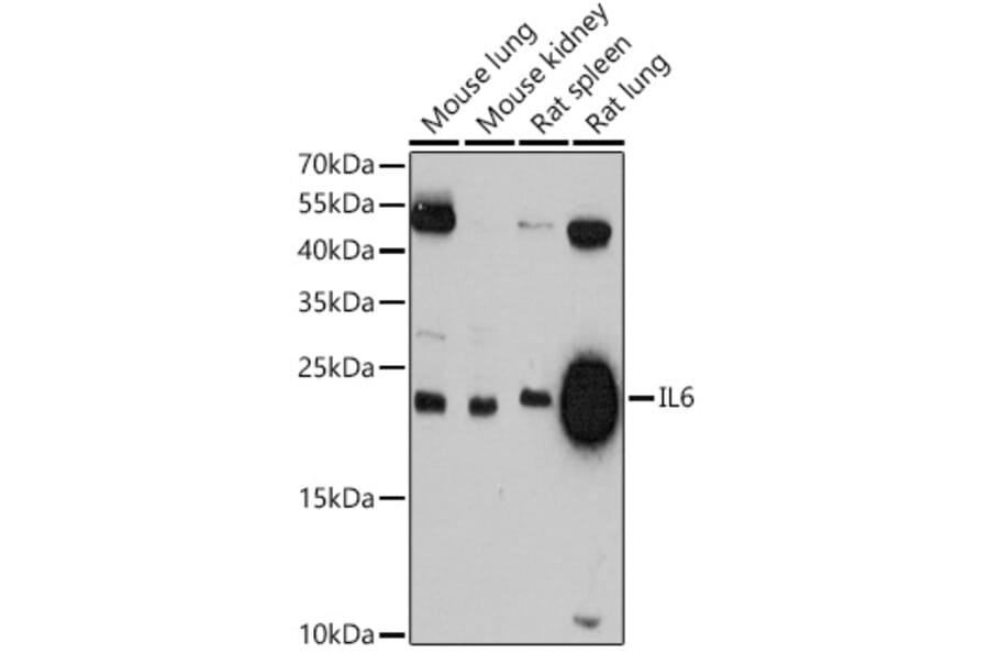 Western Blot - Anti-IL-6 Antibody (A81167) - Antibodies.com