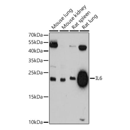 Western Blot - Anti-IL-6 Antibody (A81167) - Antibodies.com