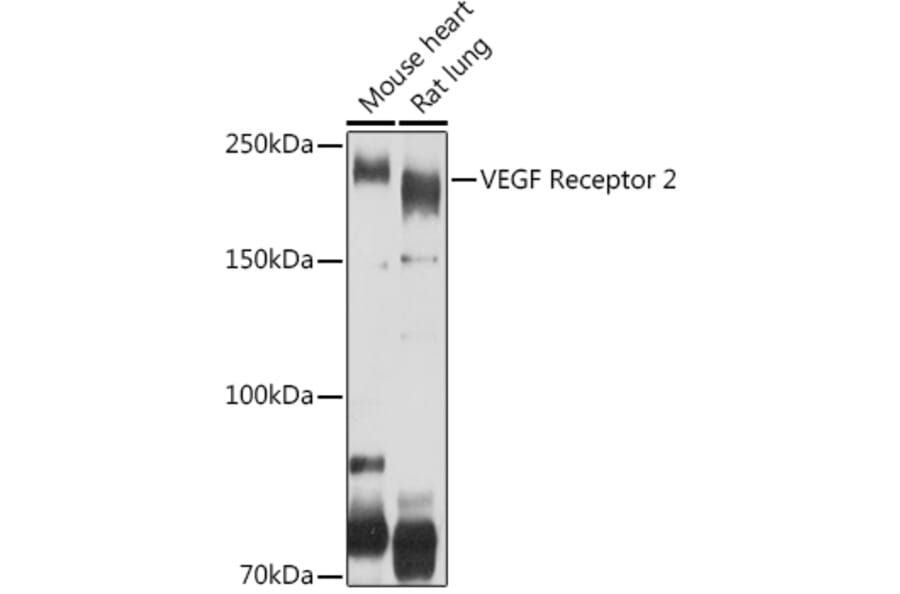 Western Blot - Anti-VEGF Receptor 2 Antibody (A81169) - Antibodies.com
