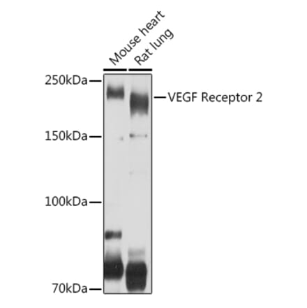 Western Blot - Anti-VEGF Receptor 2 Antibody (A81169) - Antibodies.com