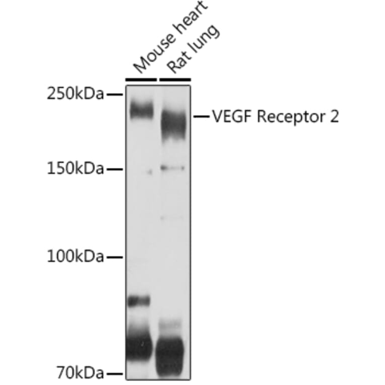 Western Blot - Anti-VEGF Receptor 2 Antibody (A81169) - Antibodies.com