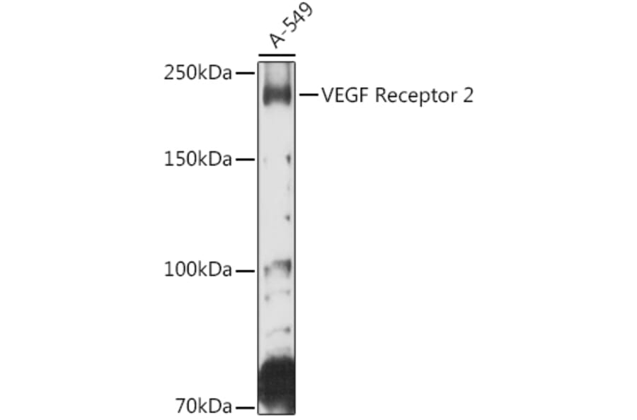 Western Blot - Anti-VEGF Receptor 2 Antibody (A81169) - Antibodies.com