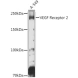 Western Blot - Anti-VEGF Receptor 2 Antibody (A81169) - Antibodies.com