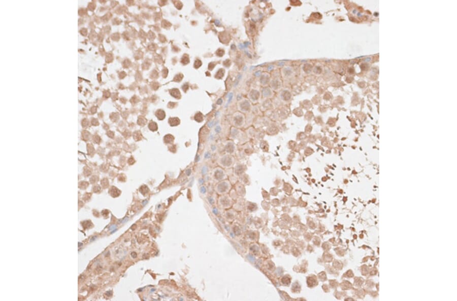 Immunohistochemistry - Anti-VEGF Receptor 2 Antibody (A81169) - Antibodies.com