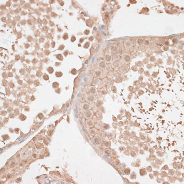 Immunohistochemistry - Anti-VEGF Receptor 2 Antibody (A81169) - Antibodies.com