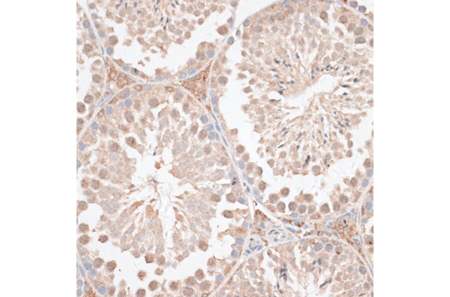 Immunohistochemistry - Anti-VEGF Receptor 2 Antibody (A81169) - Antibodies.com