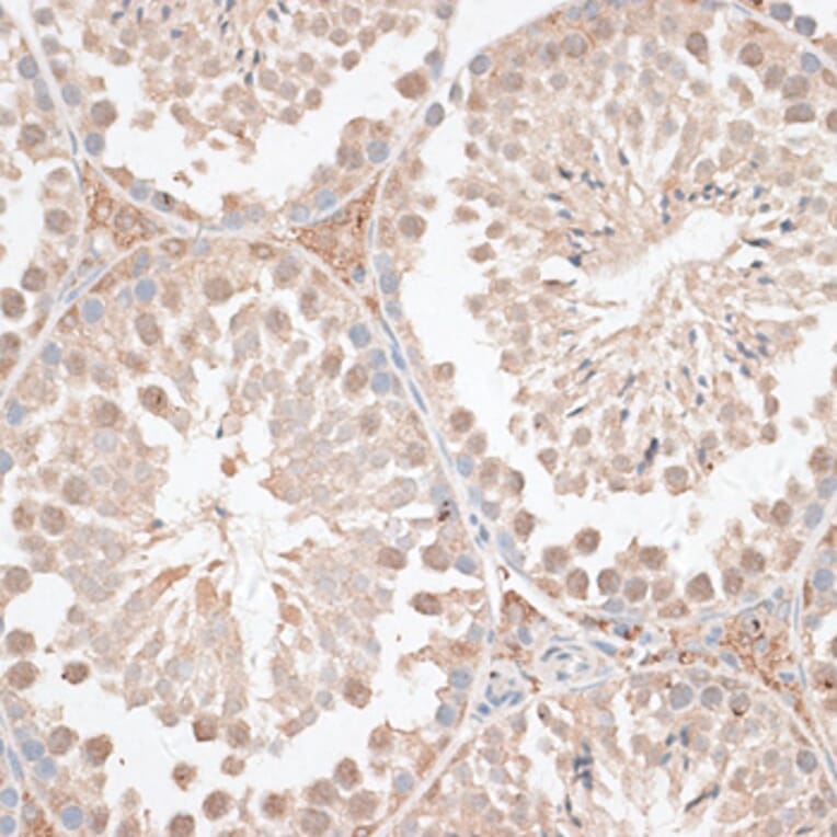 Immunohistochemistry - Anti-VEGF Receptor 2 Antibody (A81169) - Antibodies.com