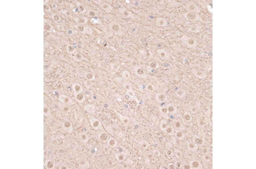 Immunohistochemistry - Anti-VEGF Receptor 2 Antibody (A81169) - Antibodies.com