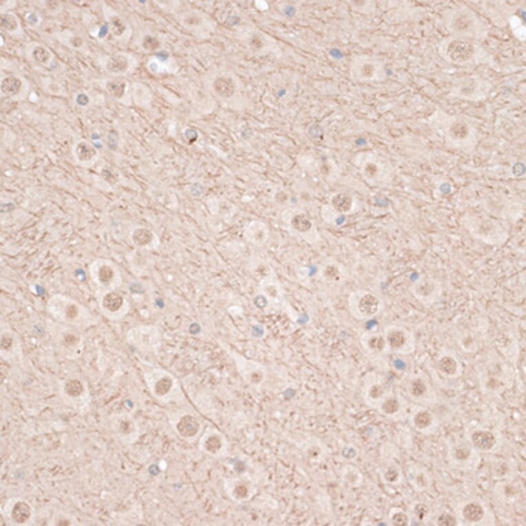 Immunohistochemistry - Anti-VEGF Receptor 2 Antibody (A81169) - Antibodies.com