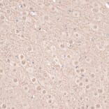 Immunohistochemistry - Anti-VEGF Receptor 2 Antibody (A81169) - Antibodies.com