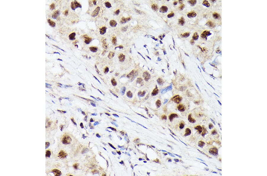 Western Blot - Anti-Cdk4 Antibody [ARC51004] (A81170) - Antibodies.com