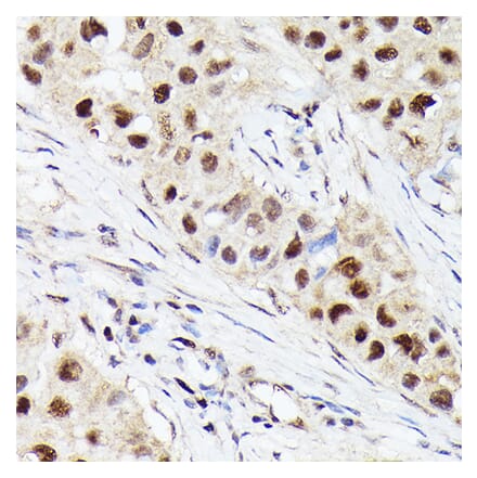 Western Blot - Anti-Cdk4 Antibody [ARC51004] (A81170) - Antibodies.com