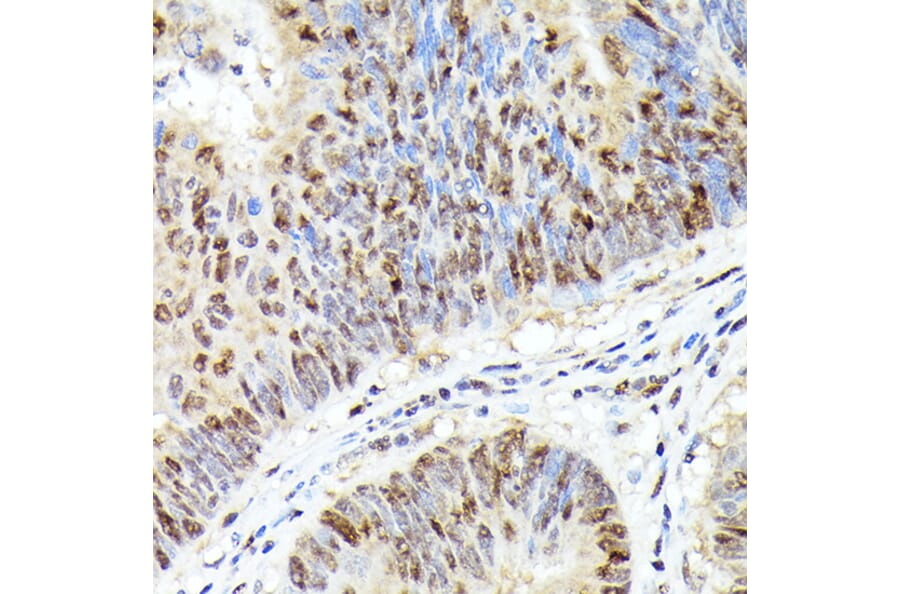 Immunohistochemistry - Anti-Cdk4 Antibody [ARC51004] (A81170) - Antibodies.com