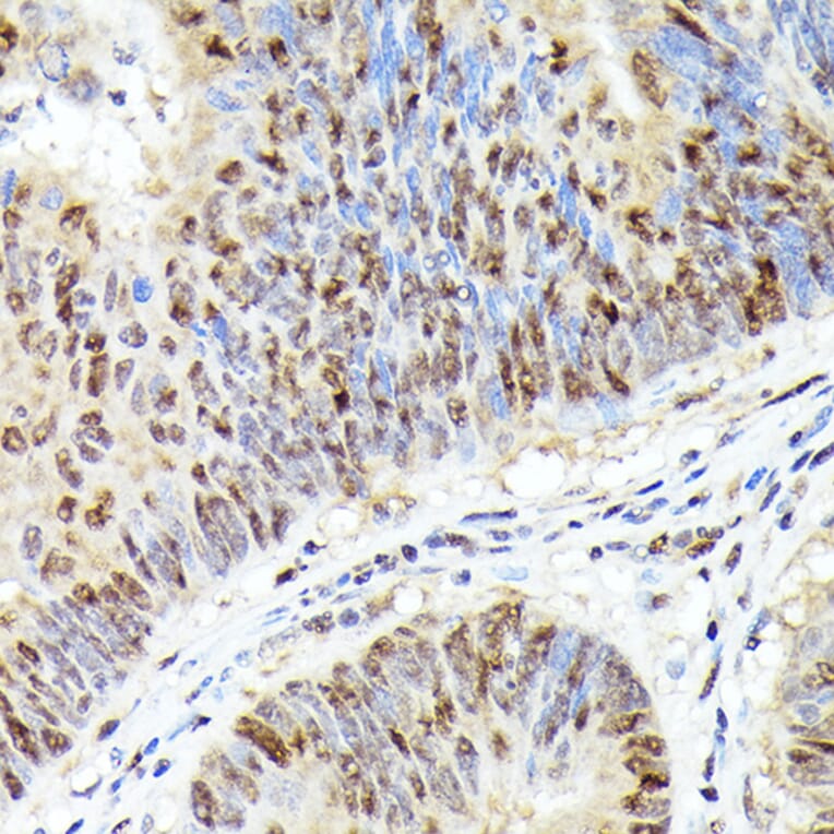 Immunohistochemistry - Anti-Cdk4 Antibody [ARC51004] (A81170) - Antibodies.com