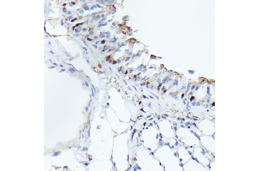 Immunohistochemistry - Anti-Cdk4 Antibody [ARC51004] (A81170) - Antibodies.com