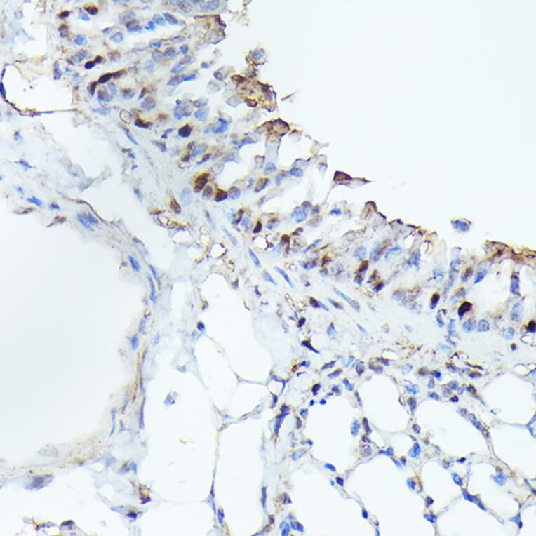 Immunohistochemistry - Anti-Cdk4 Antibody [ARC51004] (A81170) - Antibodies.com