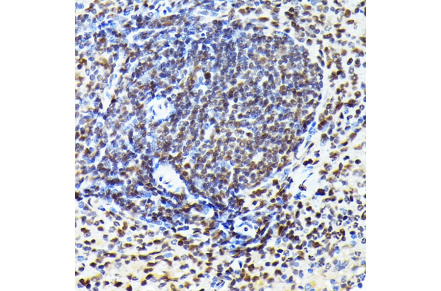Immunohistochemistry - Anti-Cdk4 Antibody [ARC51004] (A81170) - Antibodies.com