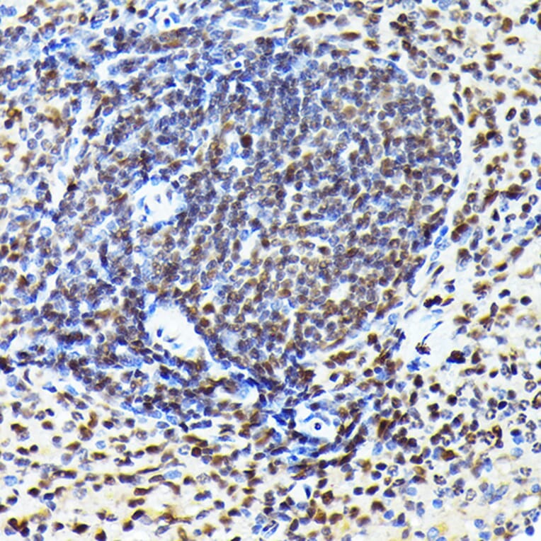 Immunohistochemistry - Anti-Cdk4 Antibody [ARC51004] (A81170) - Antibodies.com