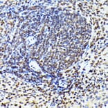 Immunohistochemistry - Anti-Cdk4 Antibody [ARC51004] (A81170) - Antibodies.com